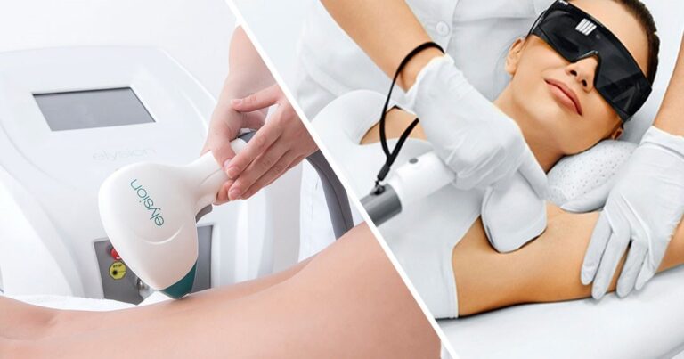 The Difference Between Ipl And Diode Laser Hair Removal Beijing Starlight Sandt Development 